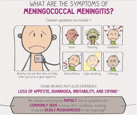 Josanne Cassar Understanding Meningococcal Meningitis