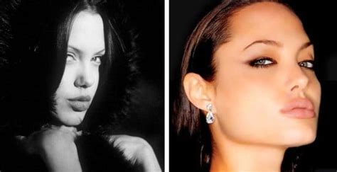 Angelina Jolie Plastic Surgery Photo Before And After CELEB SURGERY COM