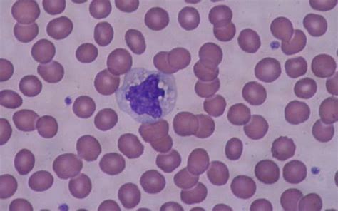 Définition Monocyte Futura Santé Cellules Sanguines Cellule