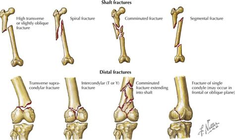 Lower Limb | Basicmedical Key