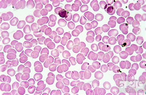 Human Blood Smear Anucleated Erythrocytes Red Blood Cells 1000 X