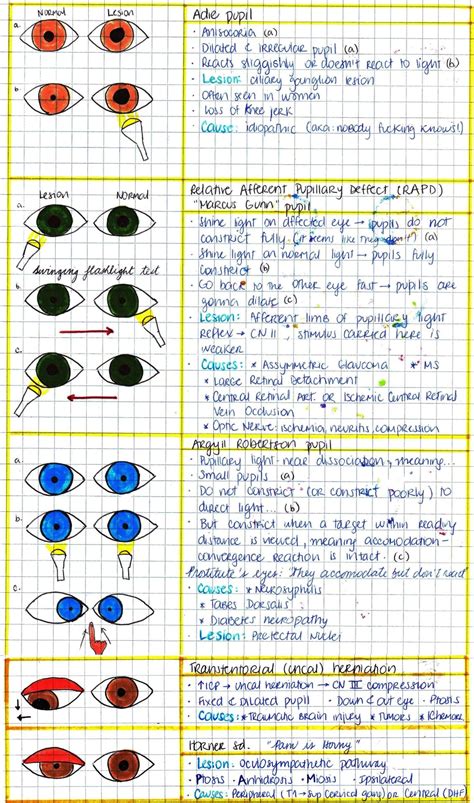 handwritten optometry education eye facts neurology