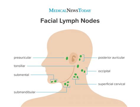 Swollen Lymph Nodes In Neck