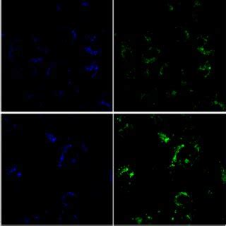 CLSM Images Of SGC 7901 Cells After Treatment With DOX Loaded FMSN CuS