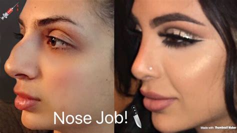 My Nose Job Plastic Surgery Tell All Sadiaslayy Youtube