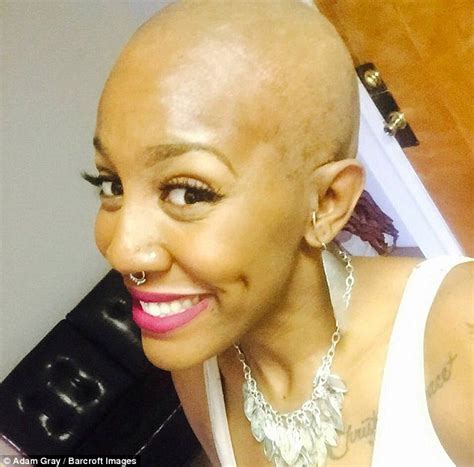 Dominique Mitchell Poses Proudly After Having Double Mastectomy Daily