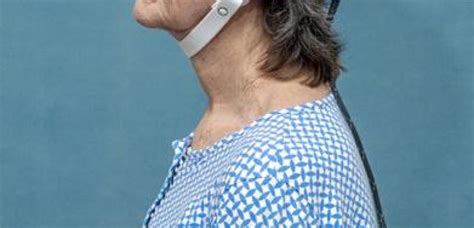 alzheimer memory loss reversed by new head device using electromagnetic waves boltz research