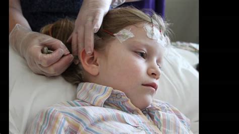 Pediatric Ambulatory Eeg For Epilepsy And Seizure Disorders In Children
