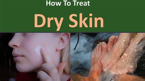 How To Treat Dry Skintry Washing With Water Only Youtube