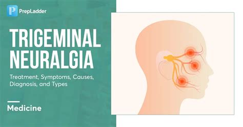 Trigeminal Neuralgia Treatment Symptoms Causes And Types