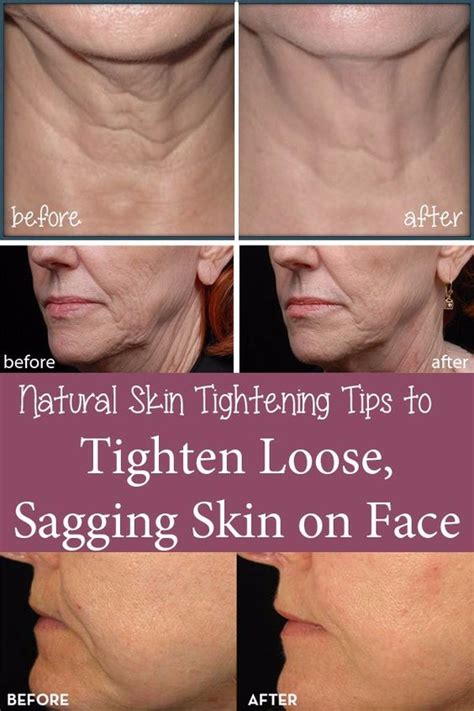 Best Natural Skin Tightening Tips To Tighten Loose Sagging Skin On
