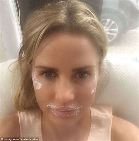 Katie Price Displays The Results Of Triple Botox Lip Fillers And