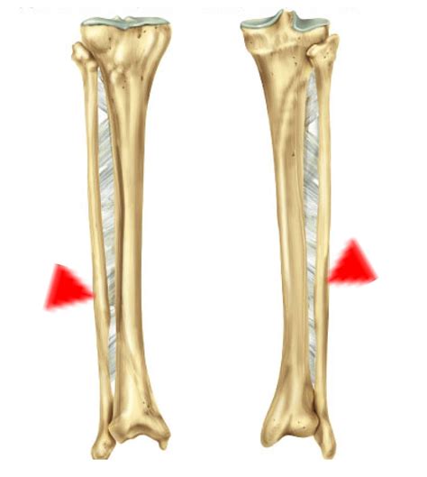 Fibula is the lateral bone of the leg which is lateral to the tibia. 301 Moved Permanently