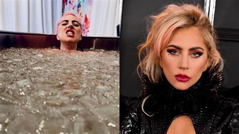 Lady Gaga Shares Photo From Ice Bath After Falling Off Stage YouTube