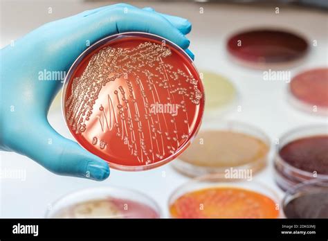 Escherichia Coli Colonies Gram Negative Bacilli Colonies As Test On
