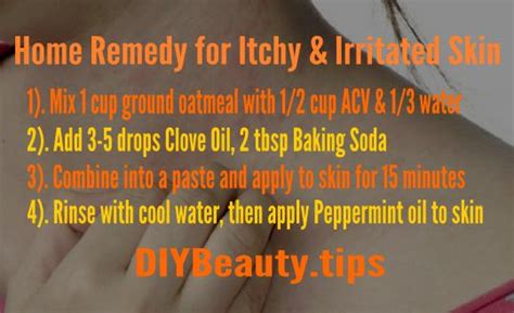 Home Remedy For Itchy And Irritated Skin Diy Beautytips