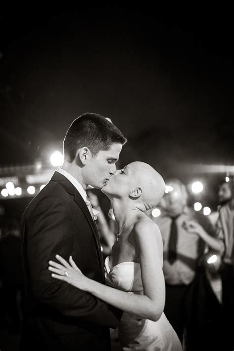 Courageous Bride Proves Bald Is Beautiful