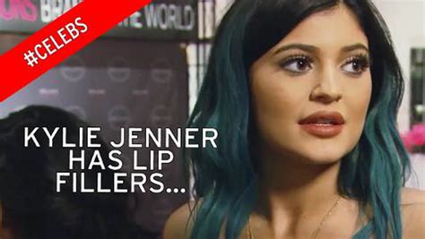 khloe kardashian shows fuller lips as she pouts after defending kylie jenner s fillers irish