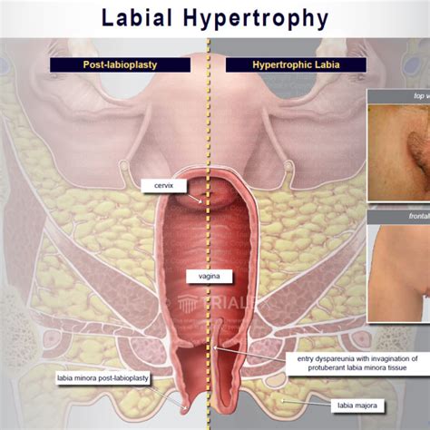 Medical Legal Exhibits Legal Animations And Trial Graphics Tria