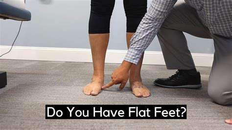 How To Tell If You Have Flat Feet Youtube