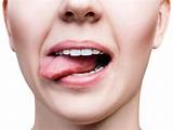 Dry Mouth Mayo Clinic Pictures
