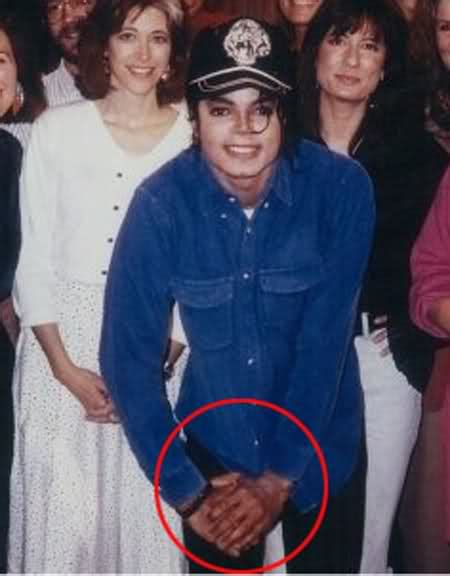 The Vitiligo Proof Michael Jackson Photo 32272000 Fanpop