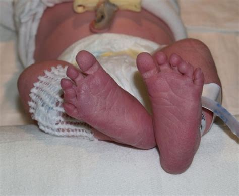 General Newborn Nursery Stanford Medicine