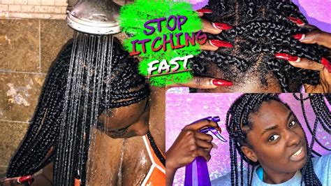 Box Braid Series Stop Itchy Scalp Fast Alexuscrown Youtube