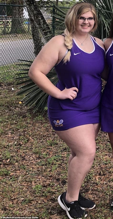 Obese 19 Year Old Loses 112lbs After Realizing Her Weight Could Kill