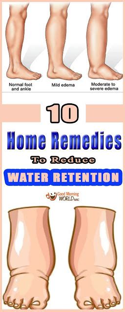 It then creates swelling in the extremities such as the legs, hands. 10 Home Remedies To Reduce Water Retention - DIY AND ...