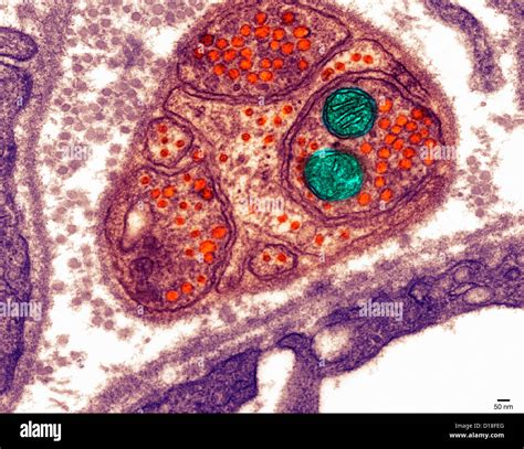 Animal Cell Under Transmission Electron Microscope Cell Organelles