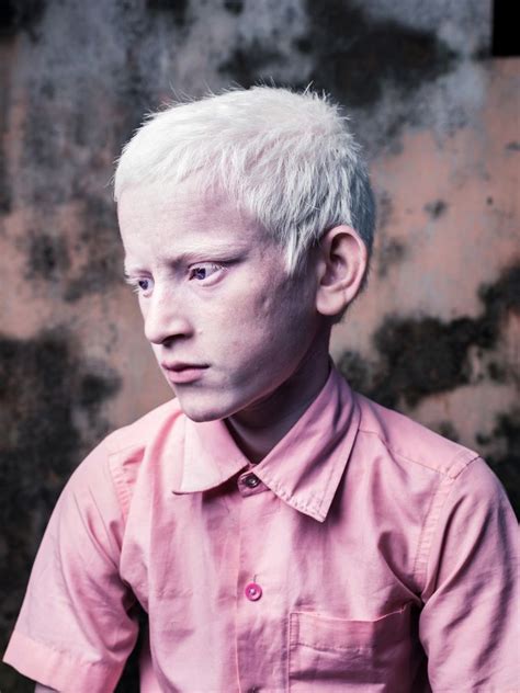 Albino Blind Wallpaper Andri
