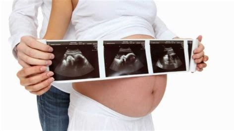 Kehamilan Mengenal Kelainan Down Syndrome Pada Kehamilan Sehatfreshcom