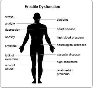 Erectile Dysfunction Diagnosis Treatment