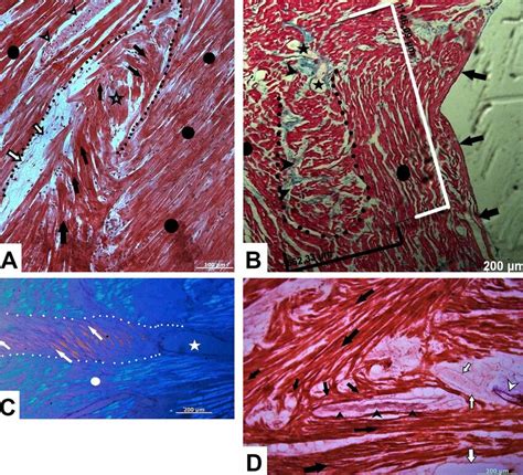Photomicrographs A Composite Tangential Section Of Rv Subendocardial