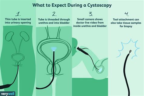 Cystoscopy Uses Side Effects Procedure Results