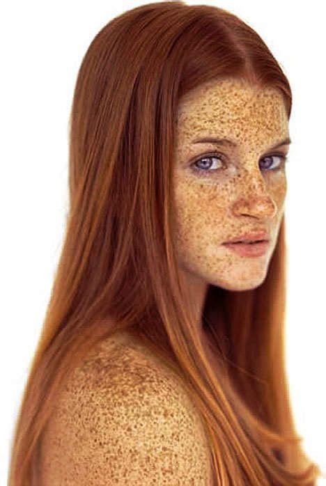 Sun Kissed All Over Freckles Beautiful Freckles Red Hair Freckles
