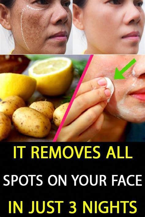 The Best Way To Get Rid Of Dark Spots From Experience Within 2 Days