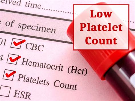 A platelet count below 20,000 is very low. 7 Natural Ways Of Increasing A Low Platelet Count ...