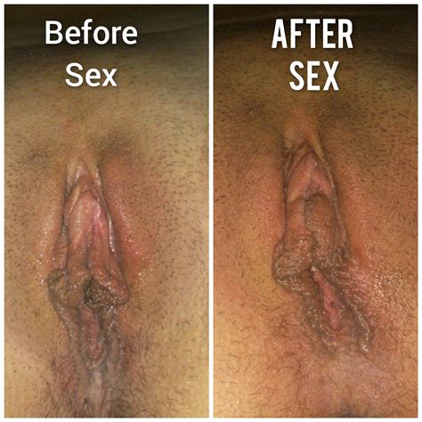 pussy comparison before and after the sex porn pic eporner