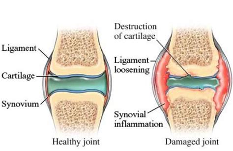 Dog bone cancer warning signs. Dog Arthritis Symptoms & Natural Remedies | Canna-Pet®