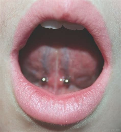 lingual frenulum piercing with black and white barbell