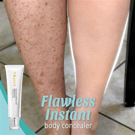 How To Cover Scars With Makeup On Legs Pretty Amazing Chatroom Navigateur