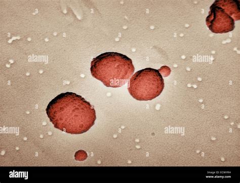 Micrografía Electrónica De Streptococcus Pneumoniae Fotografía De Stock