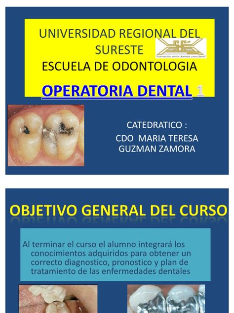 Clase De Operatoria Dental 1 Diente Humano Odontología