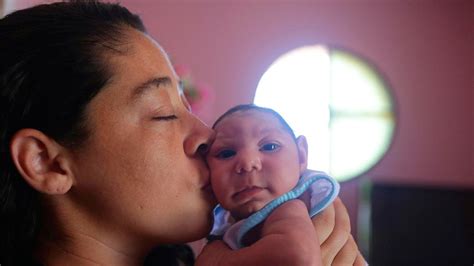 Virus Del Zika En Brasil El Relato De Las Madres De Los Bebés Que Nacieron Con Microcefalia