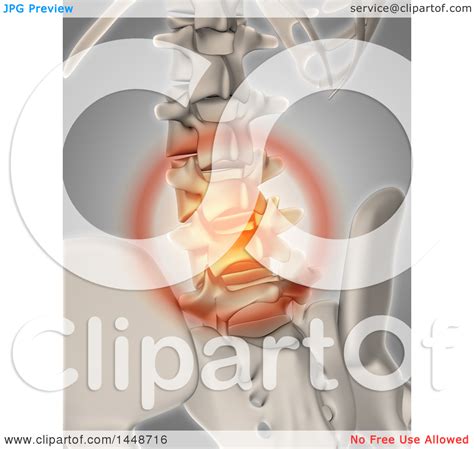 Clipart of a 3d Human Skeleton Glowing Spinal Pain, on a Gray ...
