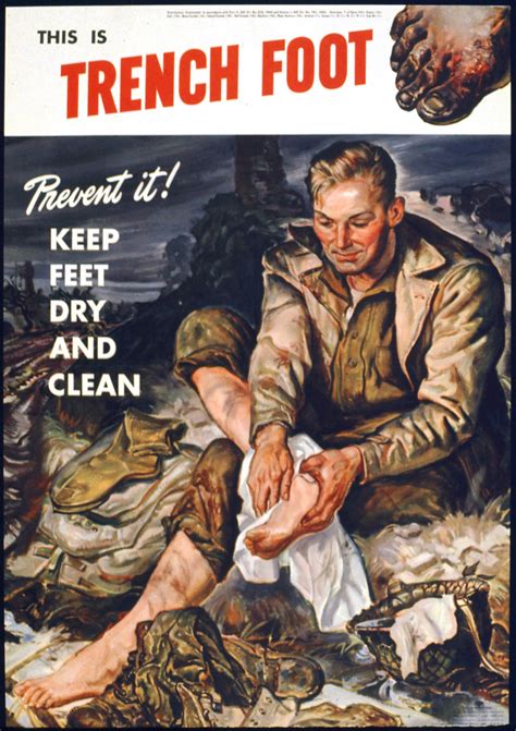 Trench Foot A Common Foot Condition In Ww1