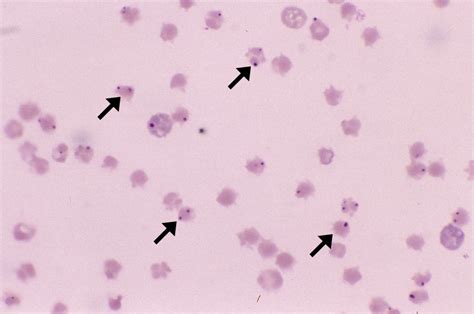 Anaplasma Marginale Cells And Smears