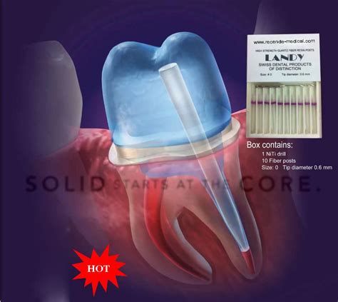 Dental Materials Fiber Resin Posts Dental Fiber Post Drill Buy